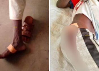 Logone Occidental : un conflit agriculteurs-éleveurs fait 3 blessés dont 1 grave