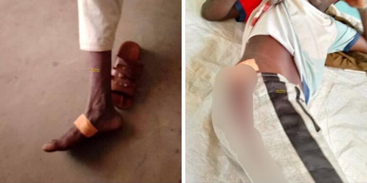 Logone Occidental : un conflit agriculteurs-éleveurs fait 3 blessés dont 1 grave