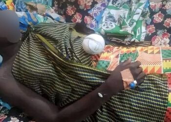 Tchad: Un jeune coupe la main d’une fille après avoir refusé ses avances.