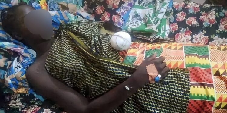 Tchad: Un jeune coupe la main d’une fille après avoir refusé ses avances.