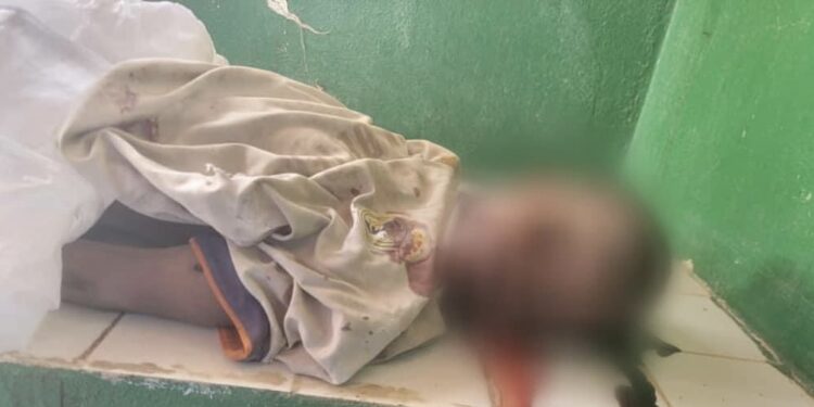 Massaguet: Percuté par une voiture, un talibé décède