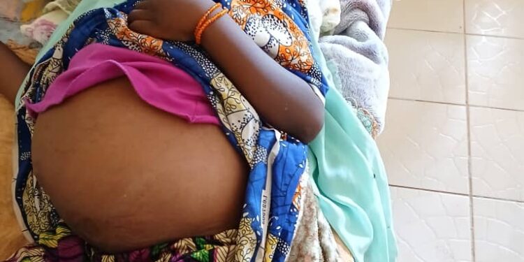 Ati : Une fillette atteinte de cirrhose en détresse vitale, un SOS lancé pour son évacuation sanitaire