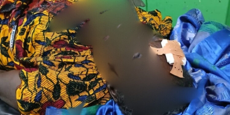 ​Moyen-Chari : Une femme grièvement blessée à l’arme blanche par son époux à Sarh