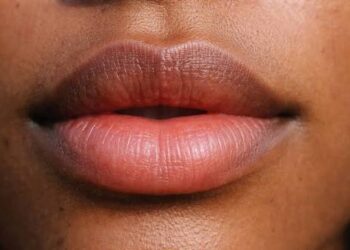 Tchad : Lèvres roses à tout prix , quand les tendances esthétiques menacent la santé des femmes